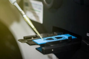 Bir Spermogramın Sonuçları Nasıl Yorumlanır?