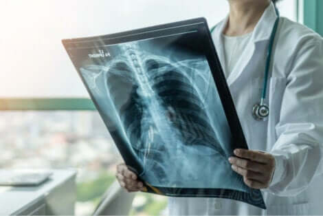 Akciğer filmini inceleyen doktor