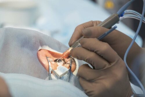 Göz ameliyatı olan bir kişi.