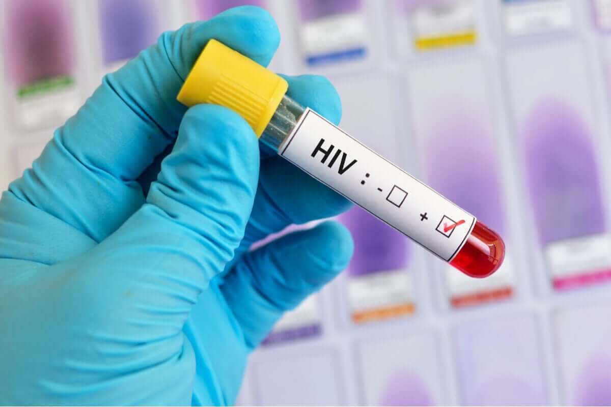 hiv testi