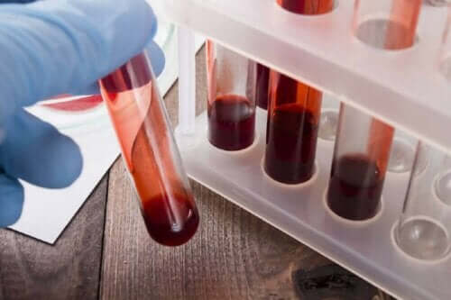 kan testi kan tüpleri hemofili