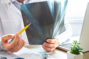 Kemik İliği Ödemi: Bilmeniz Gereken Her Şey