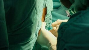 Lomber Ponksiyon Sonrası Ortaya Çıkan Baş Ağrısı