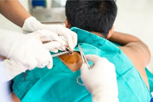 Cildindeki iyi huylu tümörler alınsın diye ameliyata girmiş bir kişi.