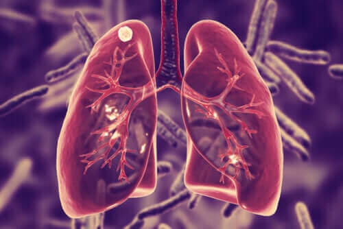 Akciğer Tüberkülozu Nedir ve Belirtileri Nelerdir?