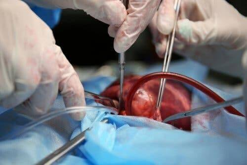 kalp nakli ameliyat 