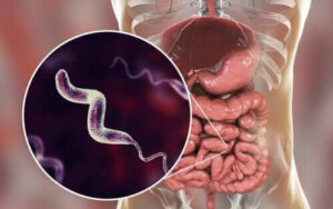 Kampilobakter Enfeksiyonların Özellikleri