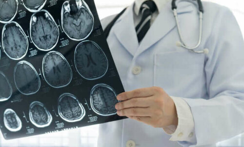 beyin röntgeni doktor