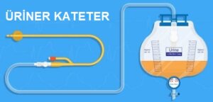 Doğum Sonrası Üriner Retansiyon Tedavisi