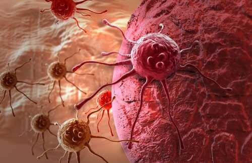kanserli hücreler 
