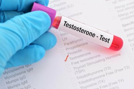 Testosteron Eksikliği Sendromu Nedir?