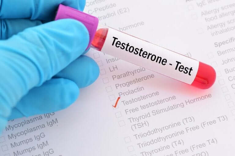 Testosteron Eksikliği Sendromu Nedir?