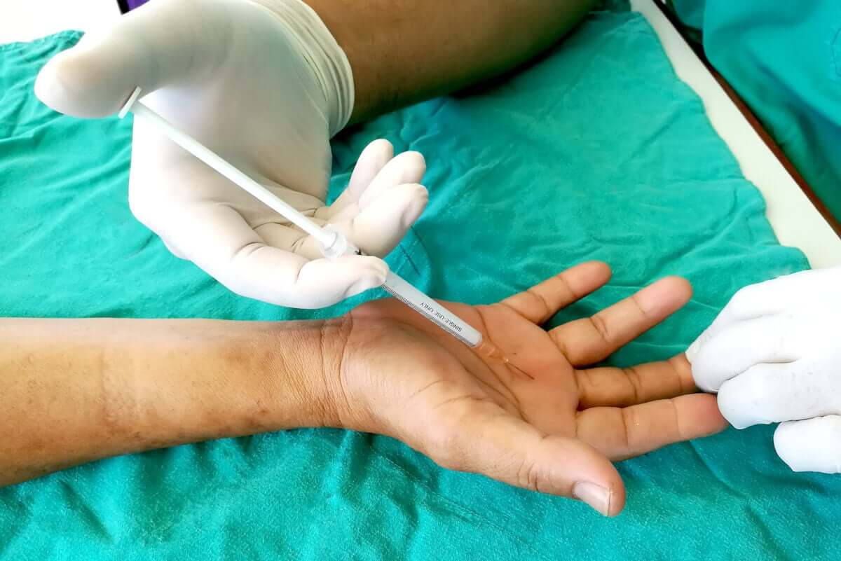 tetik parmak ve ele enjeksiyon