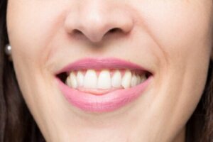 Açık Kapanış Nedir? Nasıl Düzeltilir?