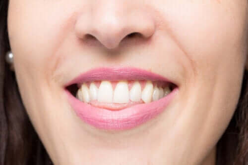 Açık Kapanış Nedir? Nasıl Düzeltilir?