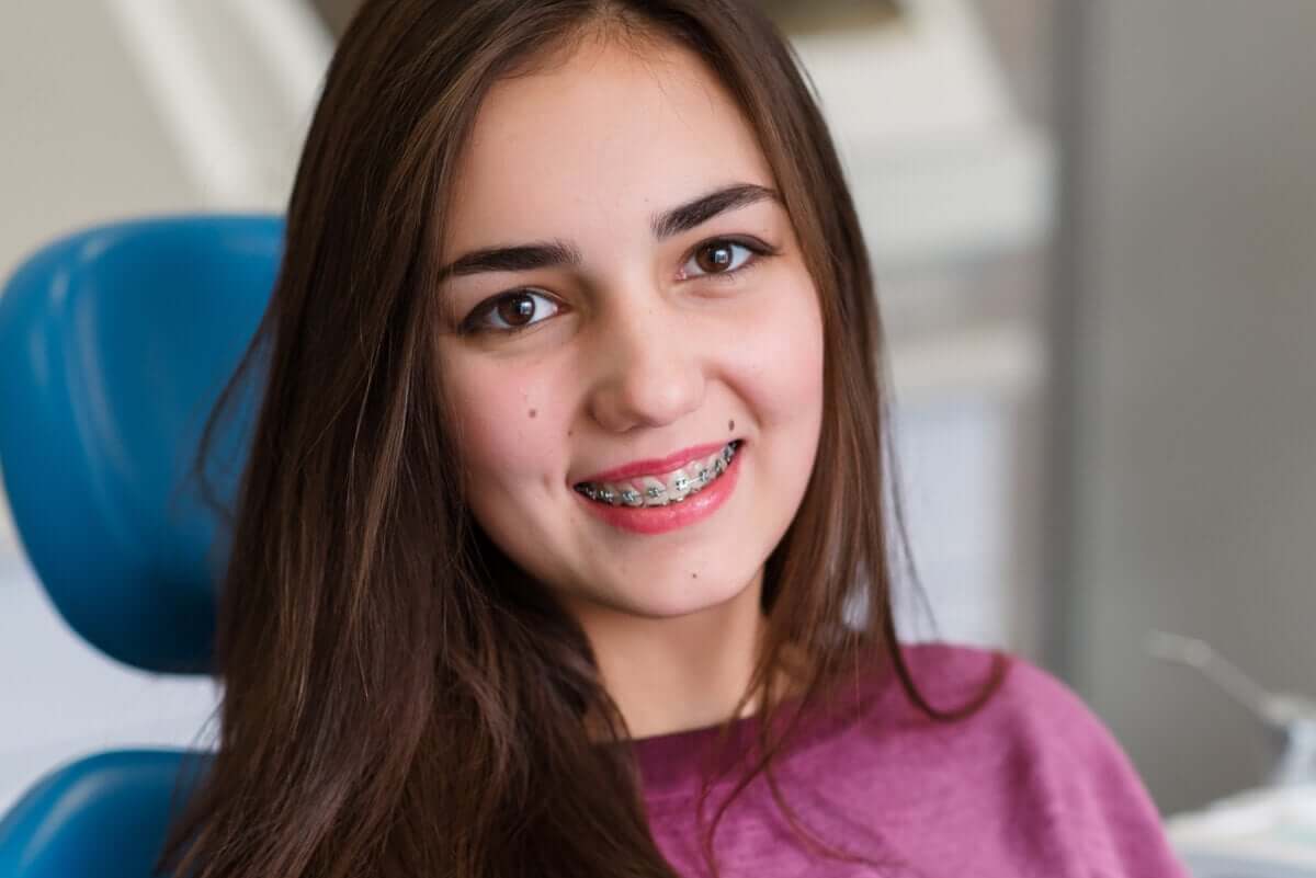 Açık kapanış gülüş