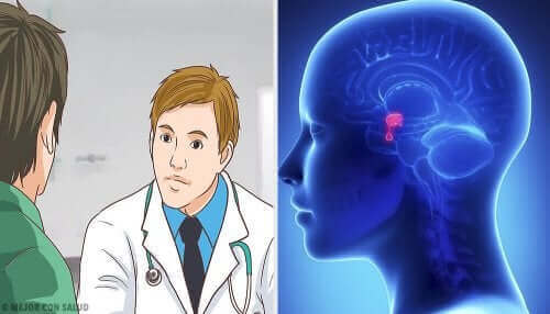 Akromegali teşhisi koymakta olan bir doktor.