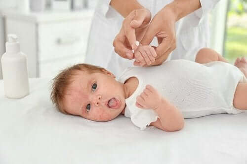Bebek Aknesi: Nedenleri ve Tedavileri