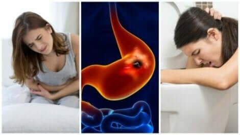 Midesi yanan ve kusan iki kadın