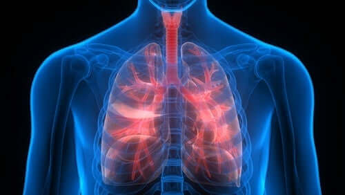 Pulmoner tromboembolizm ile ilgili bir görsel.