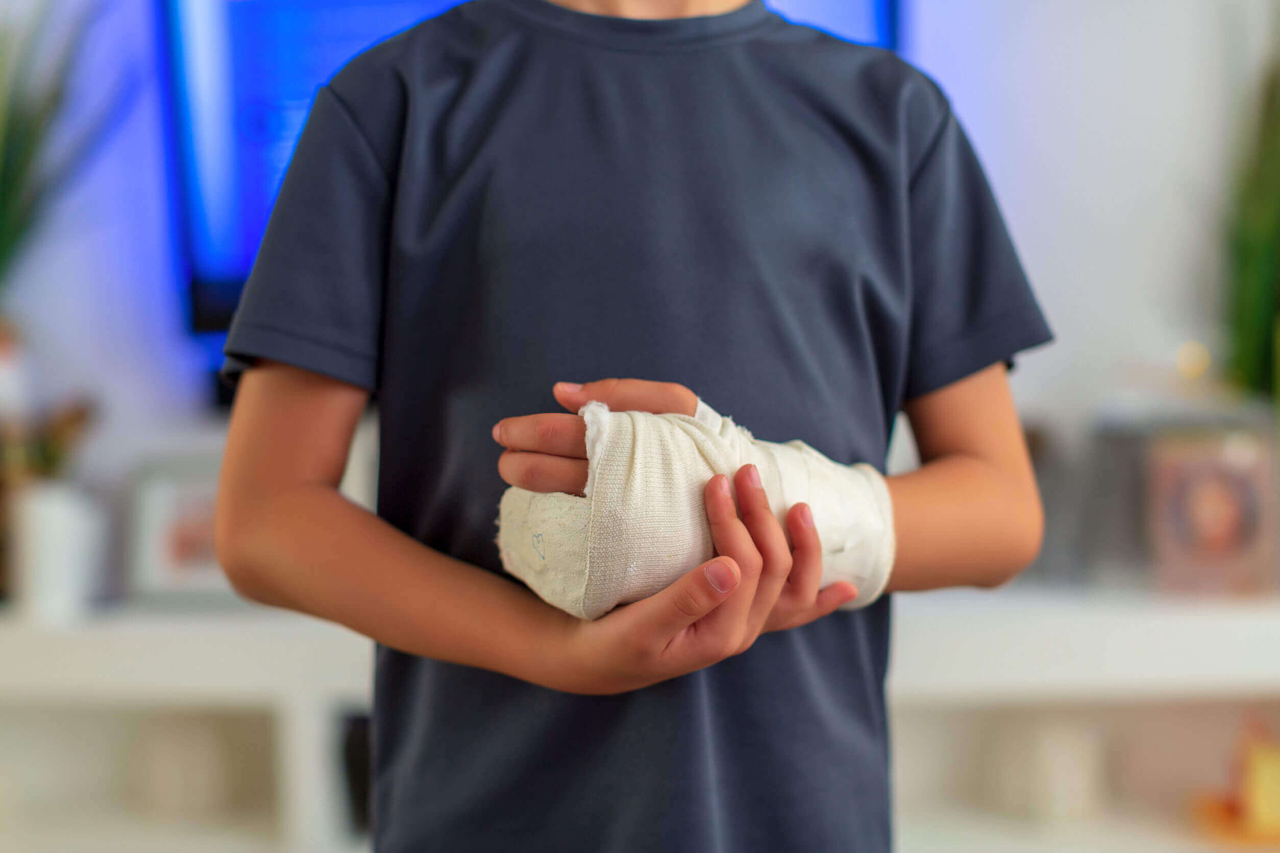 alçıya alınmış el