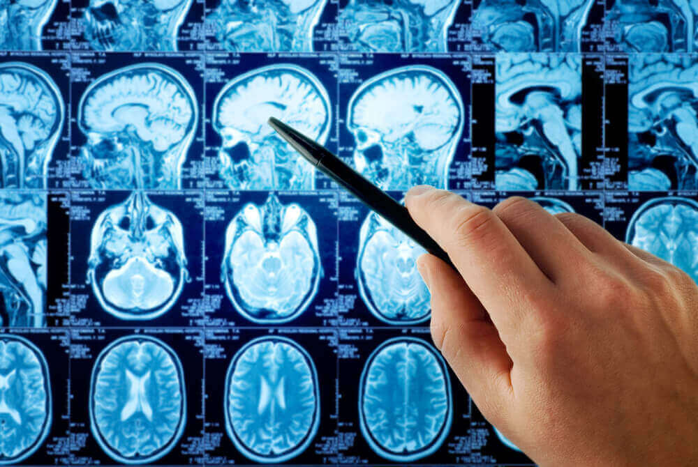 MRI görüntüleri