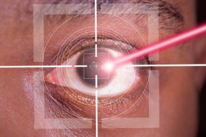 LASIK Ameliyatının Avantaj ve Dezavantajları
