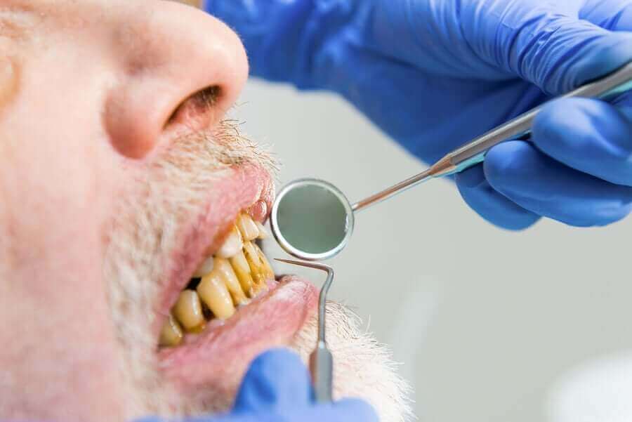 diş hekimi ziyaretindeki sararmış dişli adam