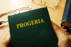 Werner Sendromu: Bir Kişi Çok Hızlı Yaşlandığında