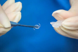 Göz İçi Lens Ameliyatı: Ne Zaman Gereklidir?