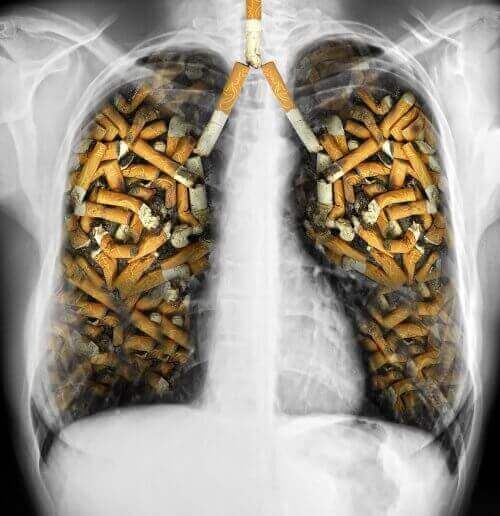 Sigara izmariti dolmuş akciğerler