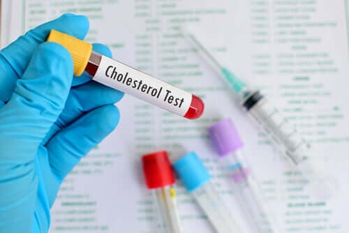 HDL ve LDL Kolesterol: Bilmeniz Gereken Her Şey