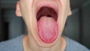 Diliniz mi Uyuştu? Bu 18 Olası Nedeni Kontrol Edin